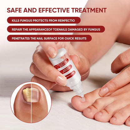 Gentle Nail Revive Solution