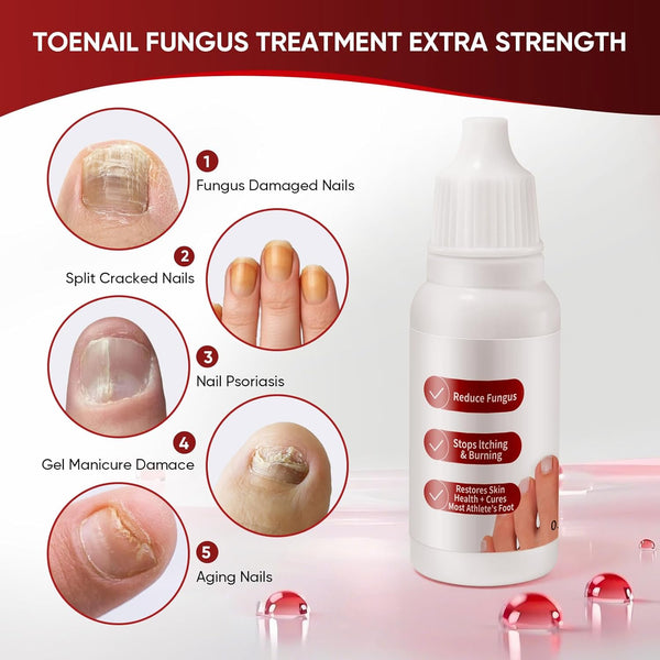 Gentle Nail Revive Solution